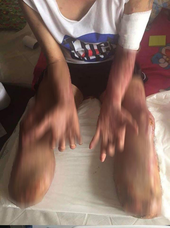 Pao alami infeski