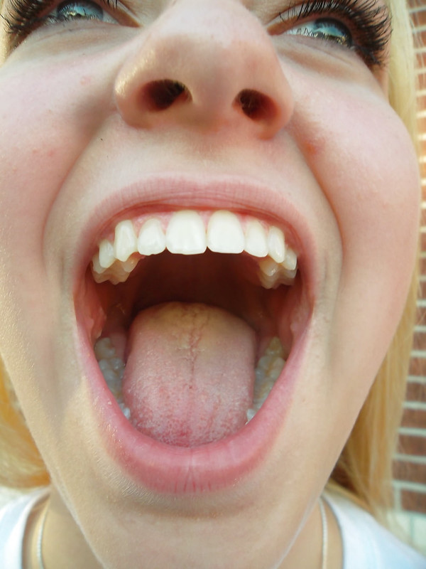 Showing uvula while braces free porn xxx pic