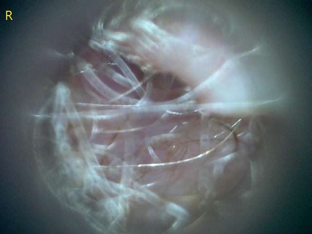 23207 177217 Into CNS 000010