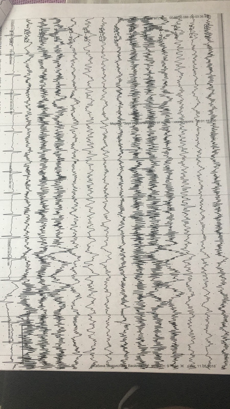 CB995DCF-AF49-4F42-B867-947B704457C2