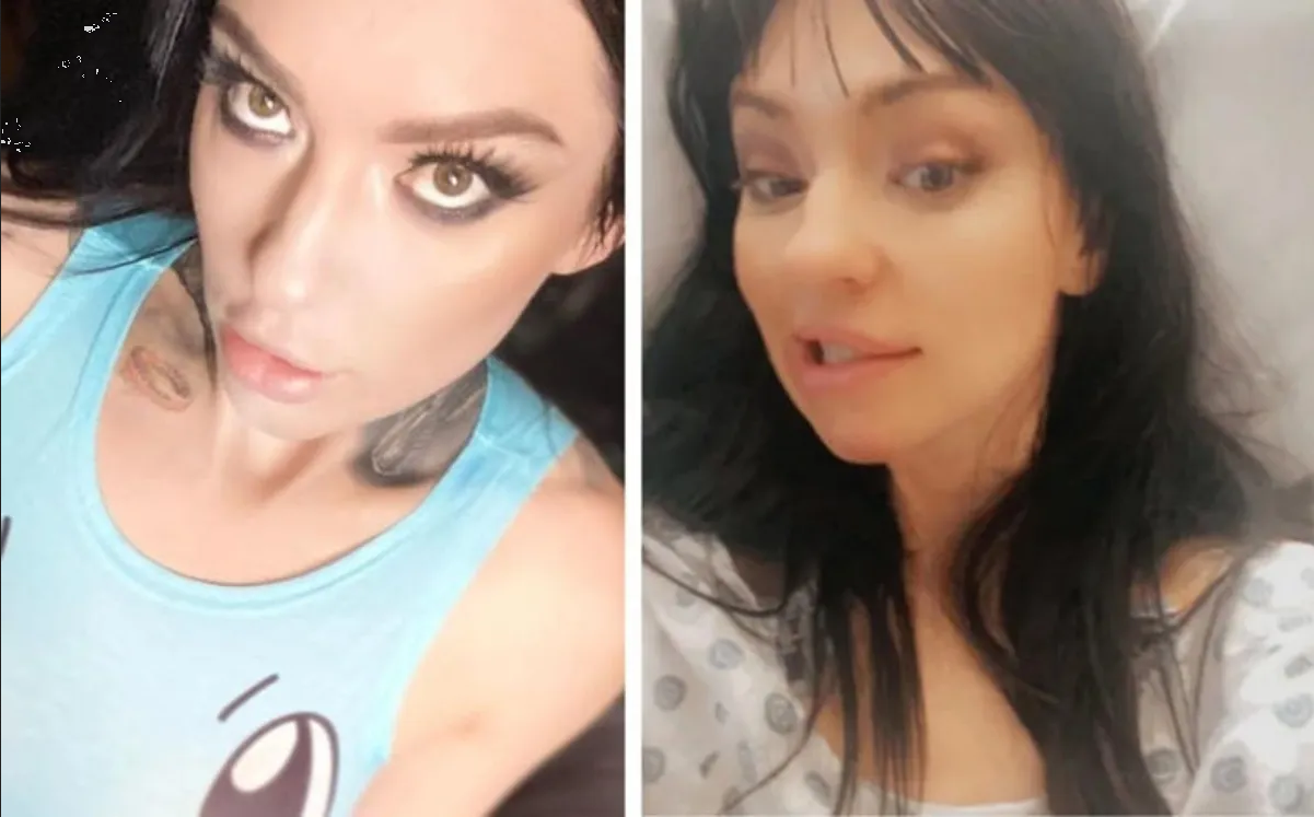 Mujer sufrió un derrame cerebral mientras tenía relaciones con su cita