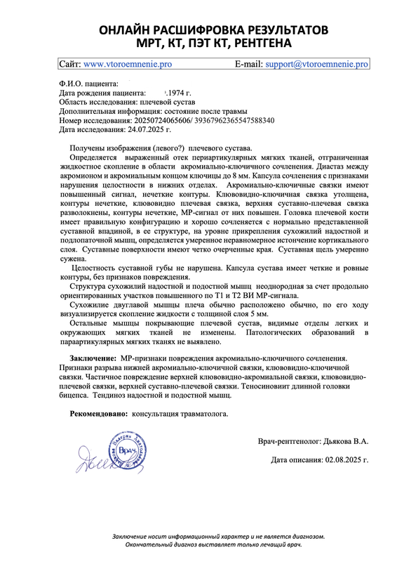 39367962365547588340 плечо