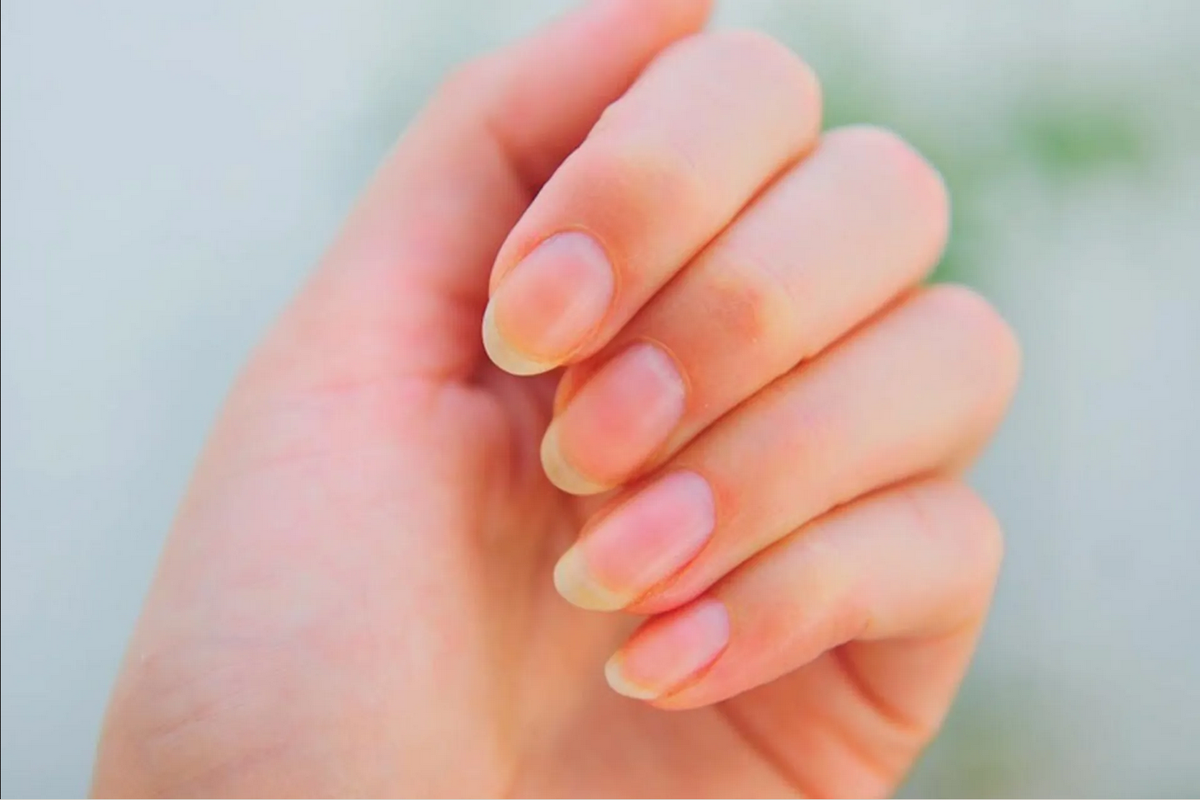 Quita lo amarillo de las uñas con ajo, ¡aquí te decimos cómo hacerlo!