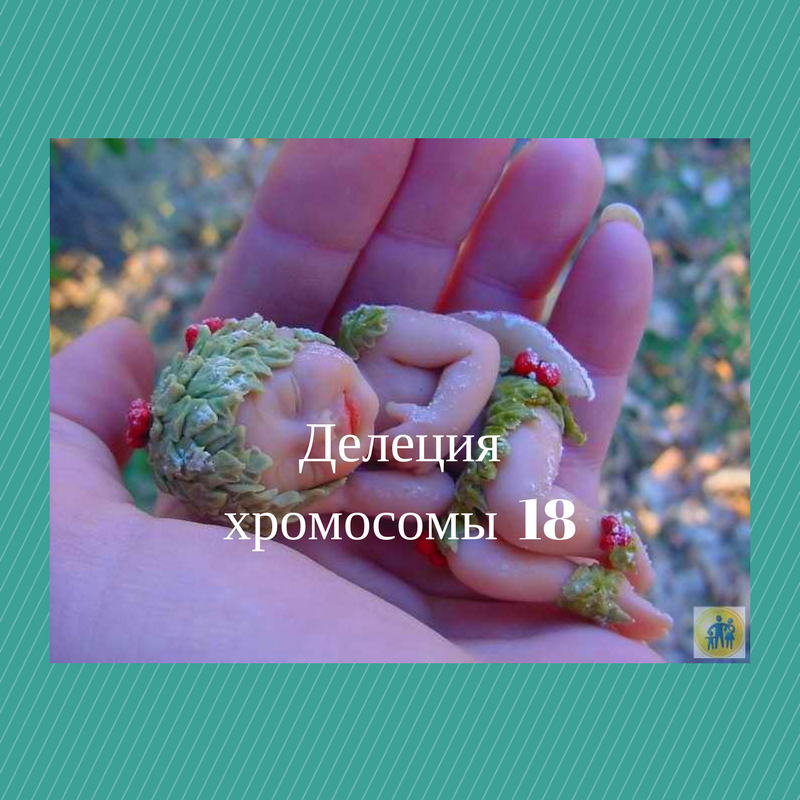 Делеция хромосомы 18