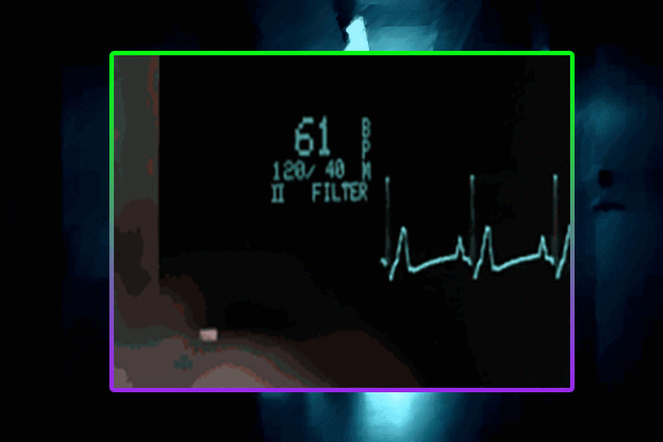[Image: ekg.gif]