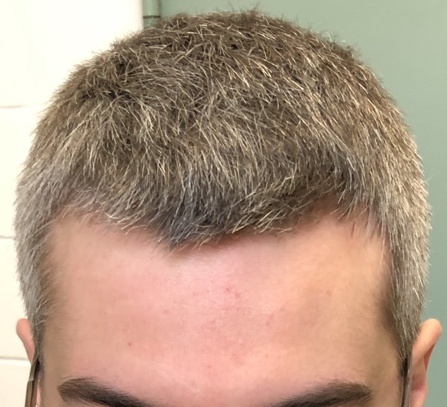 6E9862FF-F711-4C5D-A514-7B6A3861EB26