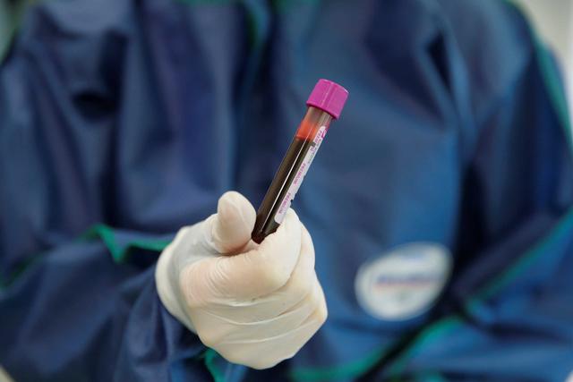 test blood