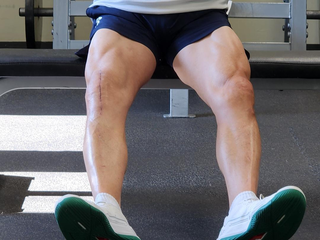 August-legs.jpg