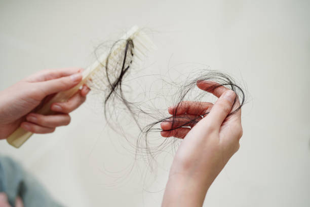 Hair-Loss-6.jpg