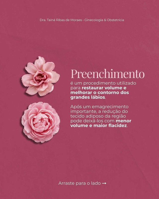 Conceito 3