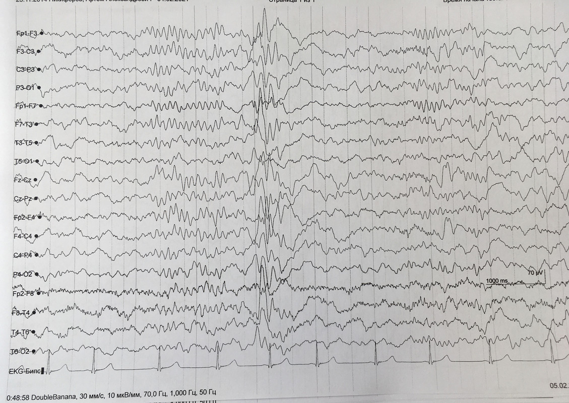 59F6E137-58A5-49B5-8250-4518916F35CC