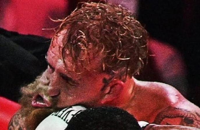 Джейк Пол: Трудно спя нощем заради счупената челюст