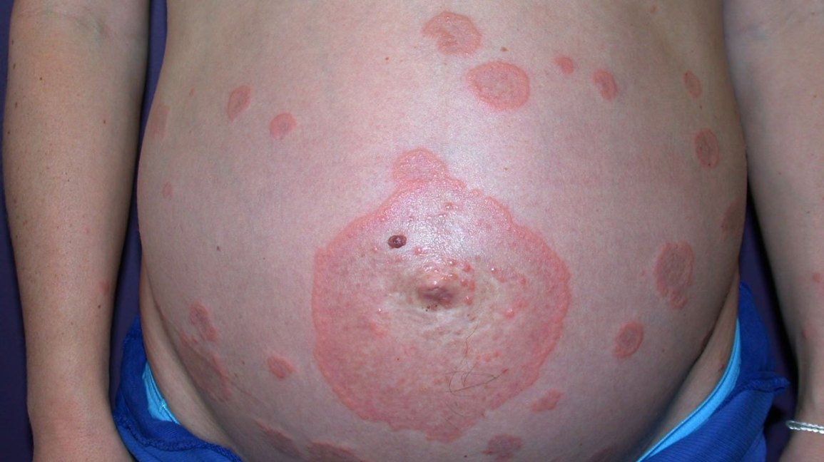 Obstetrics question 3 image
