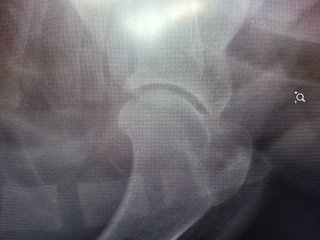 CF92C6A9-A655-4310-88B4-6446F7E8DC56