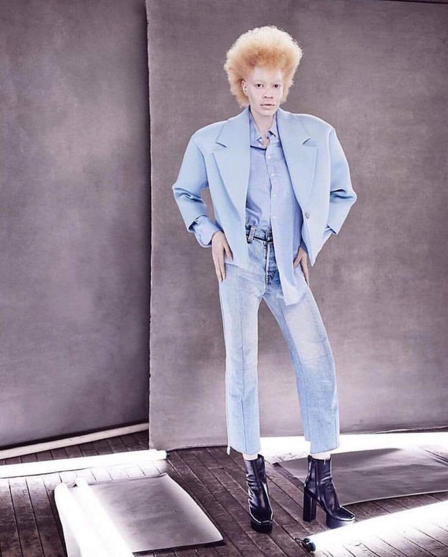 Афроамериканская модель с альбинизмом поразила всех своей необычной внешностью