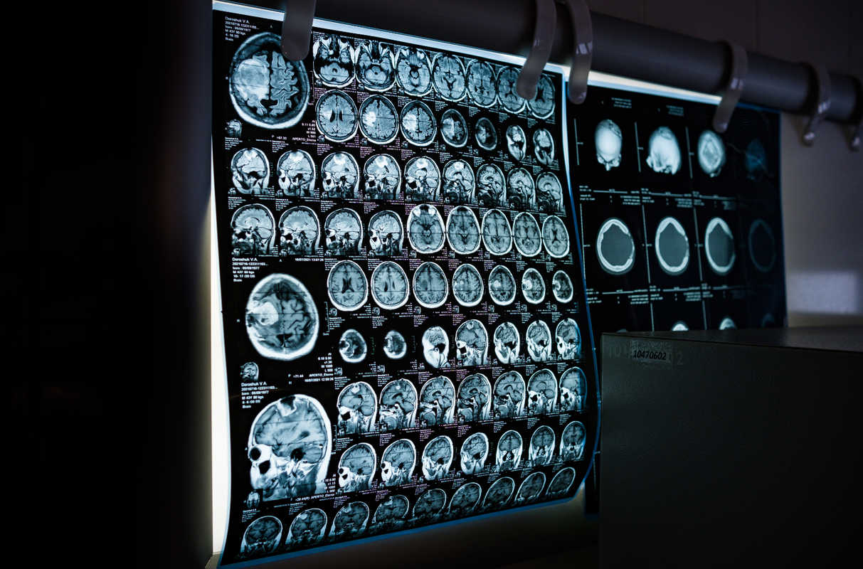 Medical AI