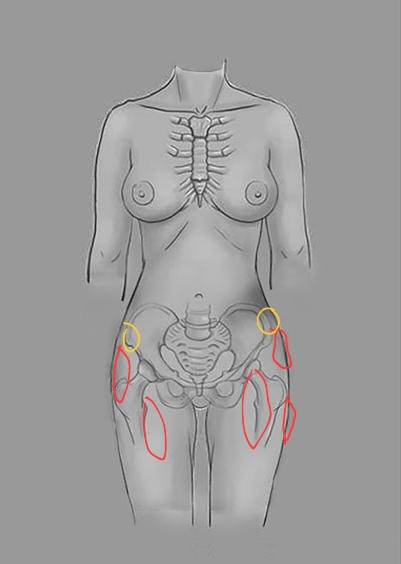 10-1055-s-0042-1749099-i2140992-1