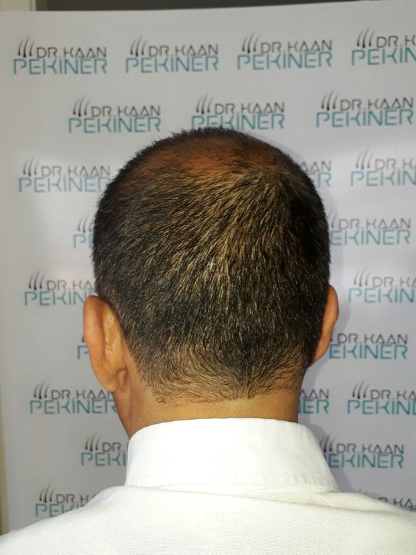 WhatsApp Image 2017-06-06 at 21.12.45