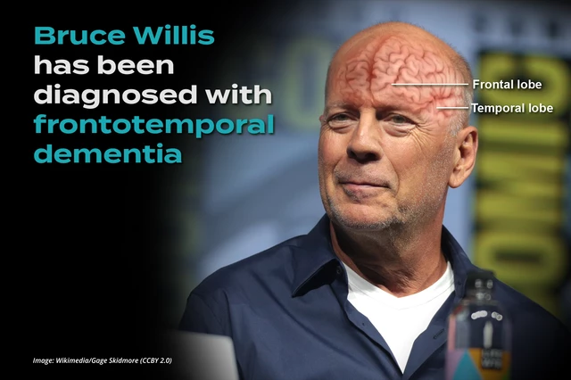 Bruce Willis