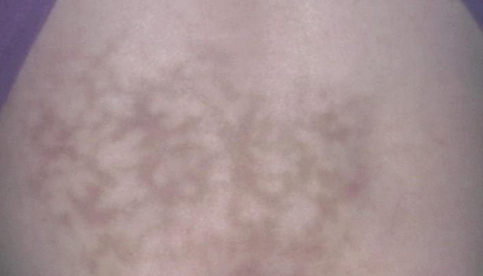 99157665-173009137422478-5469315743906529280-n.jpg