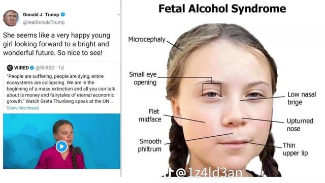get-woody-to-analyze-greta-thunberg-for-fetal-alcohol-v0-8esm69rijb9a1.jpg