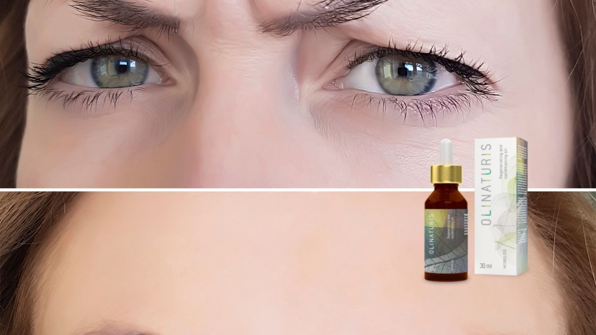 Olinaturis Serum