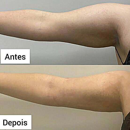 Projeto 11
