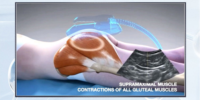 HI-EMT Technology Principle