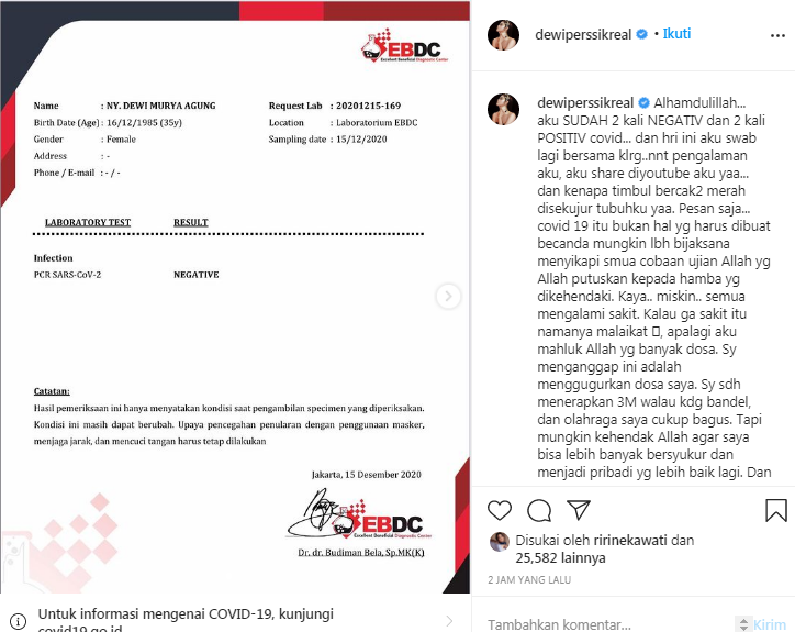 Dewi Perssik bagikan hasil tes swab 
