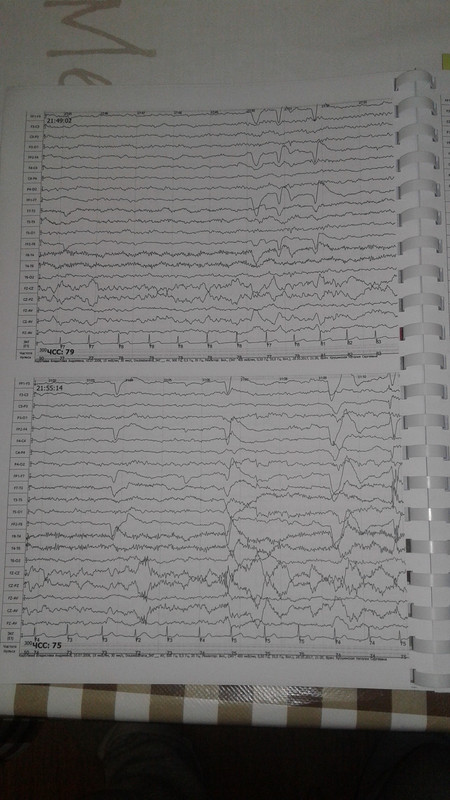 1510522470974-15402248