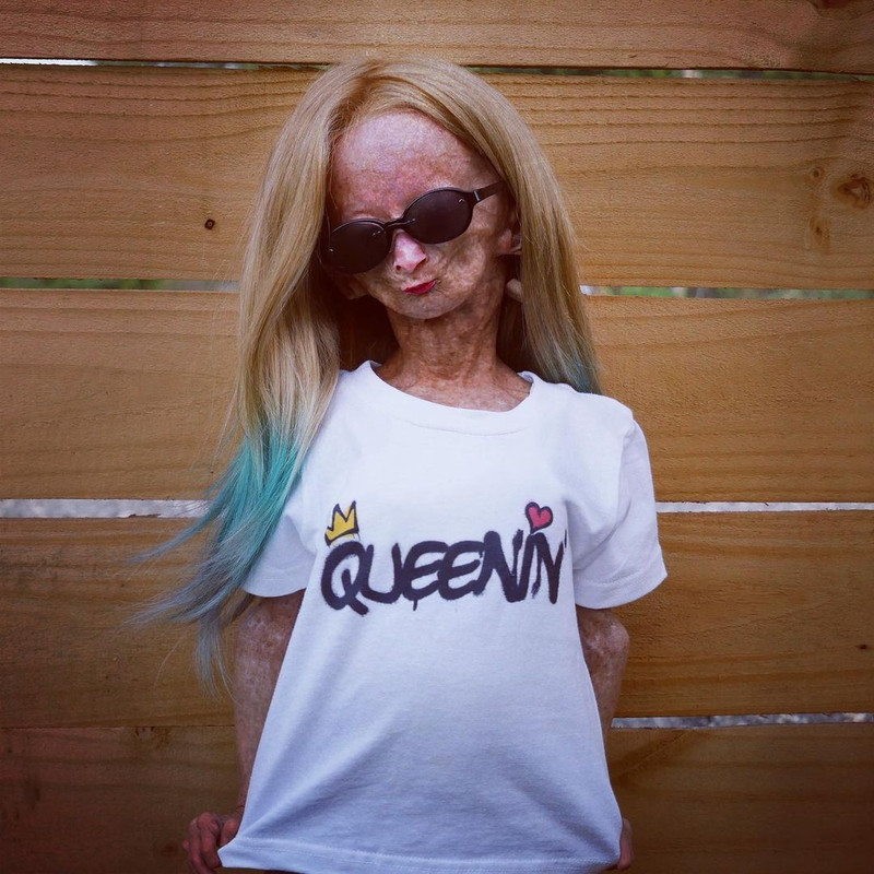 Adalia Rose kini jadi selebgram dan YouTuber