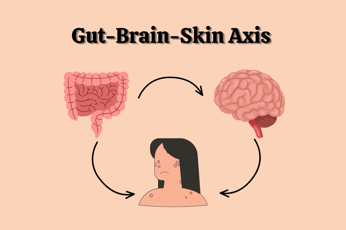 Gut, skin and brain are connected with each other.