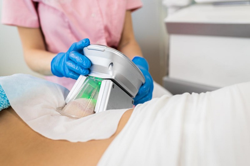 fat removal