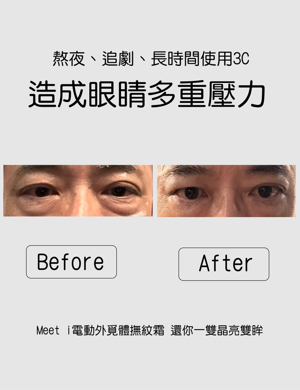 meet i 外覓體電動撫紋撫紋眼霜