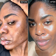 Before and After