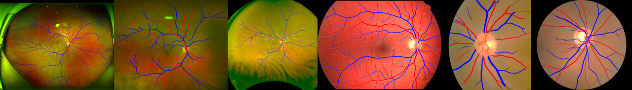 Segmentation results