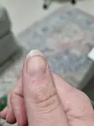 6-years-searching-for-diagnosis-just-found-multiple-v0-1huupu6kxyod1