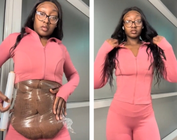 Woman's Trick To Hide Loose Skin On Her Belly After Massive Weight Loss Stuns People