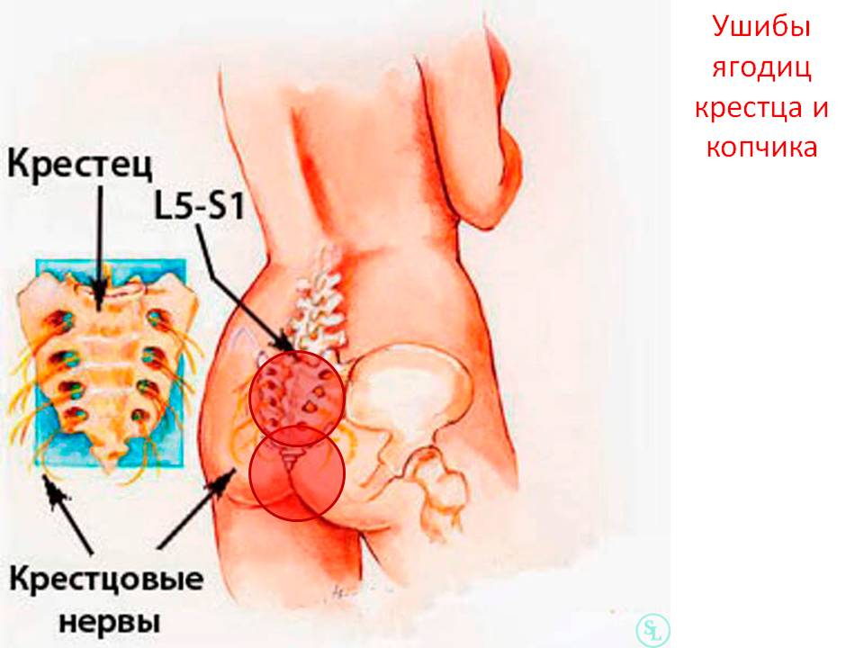 Болит поясница киста. Боли в области крестцового отдела. Поясничный отдел позвоночника и крестец. Крестцово-копчиковый отдел позвоночника. Крестец и копчик.