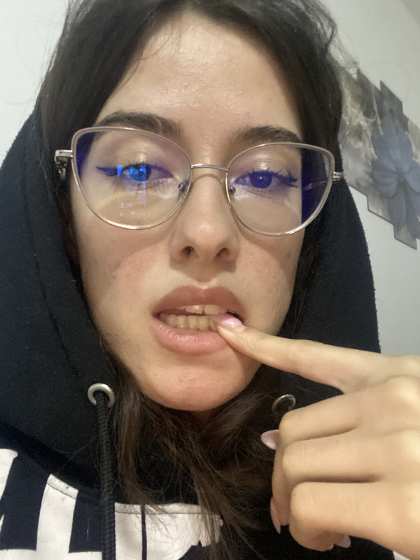 IMG 2415