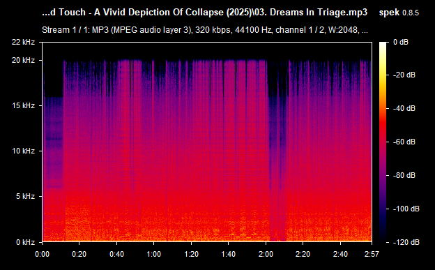 03. Dreams In Triage.mp3