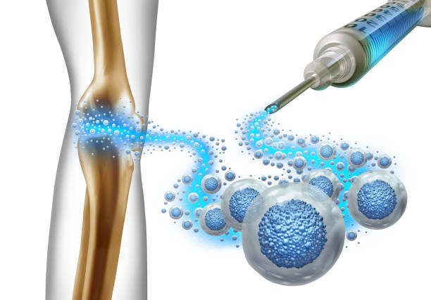 stem cell therapy packages Mexico