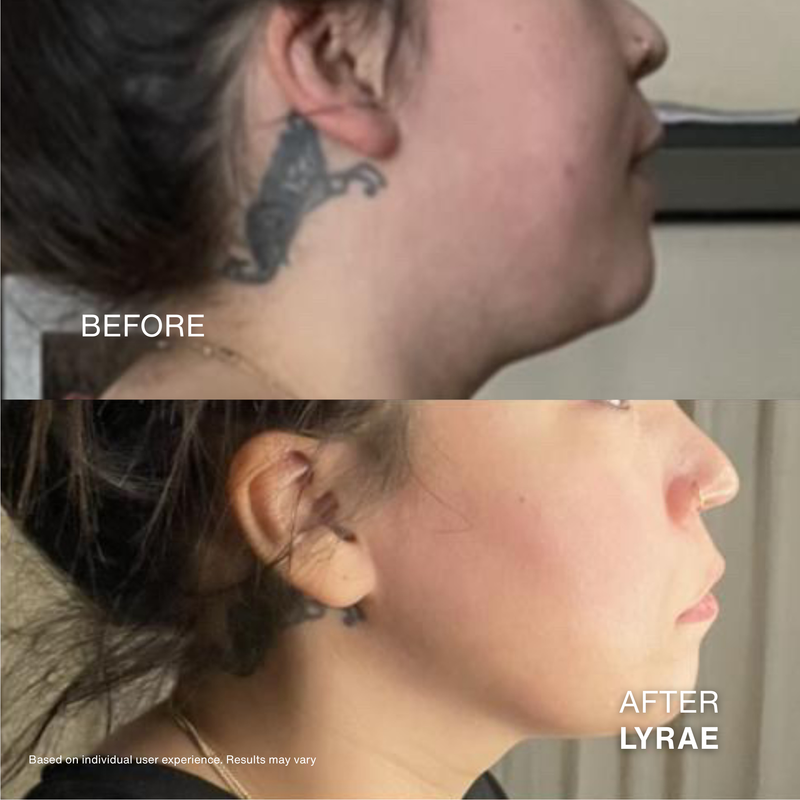 Rebecca before and after