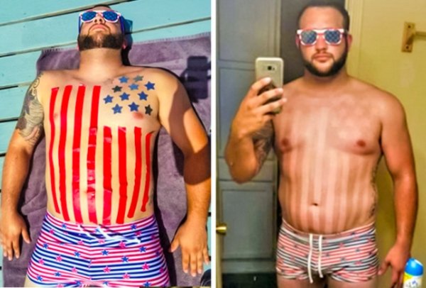 Before-After-25