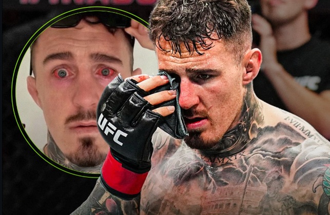 Драмата с Том Аспинал! Защо UFC вече не го хареват?