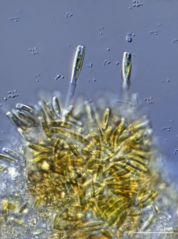 Achnanthes 01 (ev) sp Aufsitzer-Alge Kolonie DIK 50