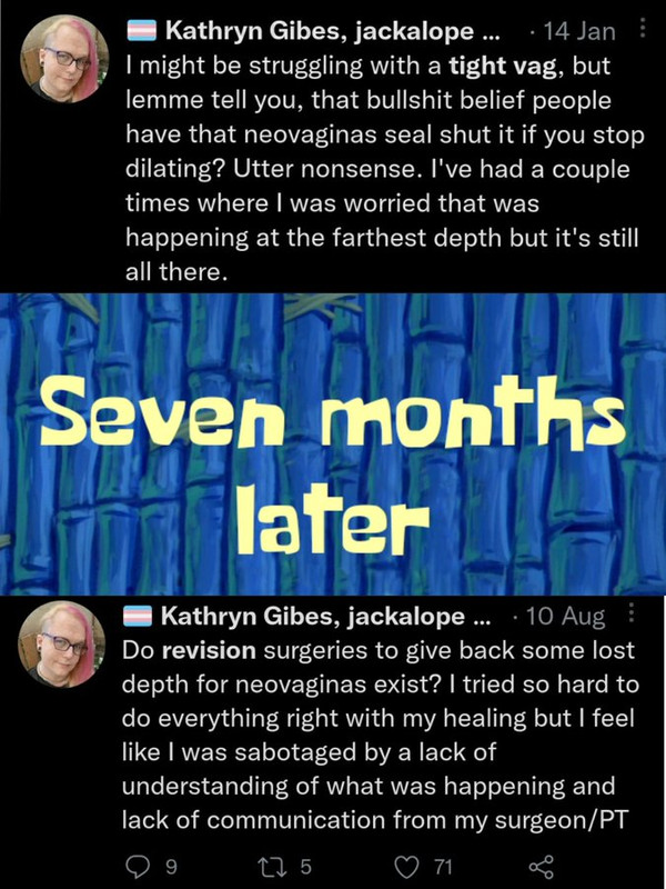 tranny tight vag revision surgery