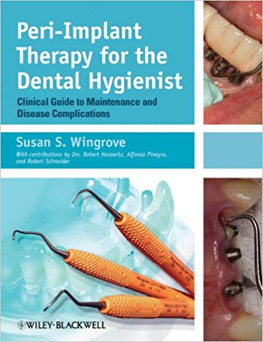 Peri-Implant Therapy for the Dental Hygienist: Clinical Guide to Maintenance and Disease Complica... Peri-Implant Therapy for the Dental Hygienist: Clinical Guide to Maintenance and Disease Complica...