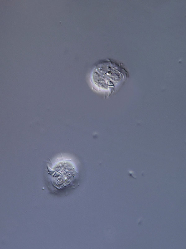 Colpoda 21 (ev) sp Heutier beim Encystieren DIK 100
