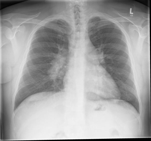 Pulmonology question 9 image